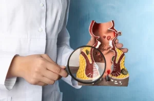Hemoroid Tedavisi